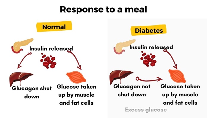 Understanding Blood Sugar Regulation